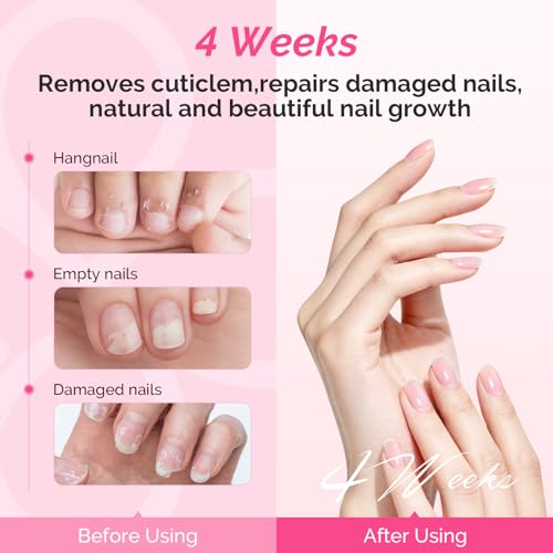 MelodySusie Manicure Tools Kit Nail Care Set | Nail Files, Buffer Blocks,Cuticle Nipper,Busher and Rose Cuticle Oil 28ML for DIY Nail Manicure and Nail Care - size: 11Pcs Rose
