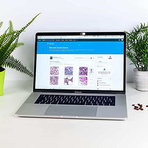 CloudValley Laptop Camera Cover Slide, Metal 0.023 Inch Ultra-Thin, Pink | Webcam Cover for MacBook Pro / Air, Laptop, iMac, iPad, iPhone 8/7, PC Accessories, Privacy Web Camera Protection, 2 Pack - color: Pink-2 Pcs