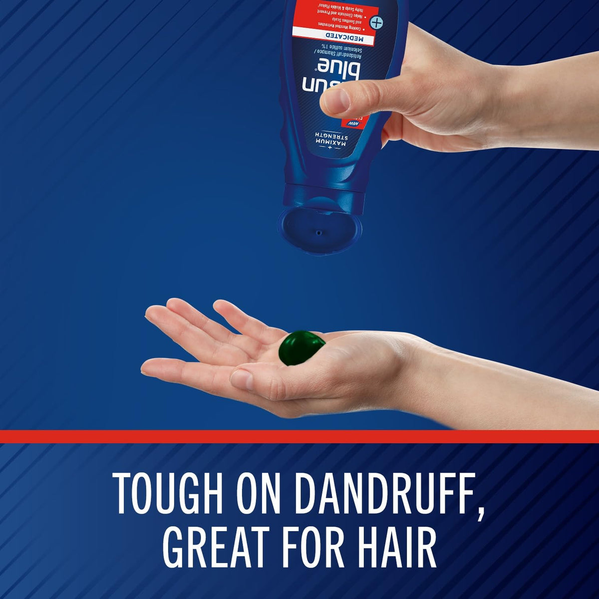 Selsun Blue Medicated Antidandruff Shampoo, 11 fl. oz.