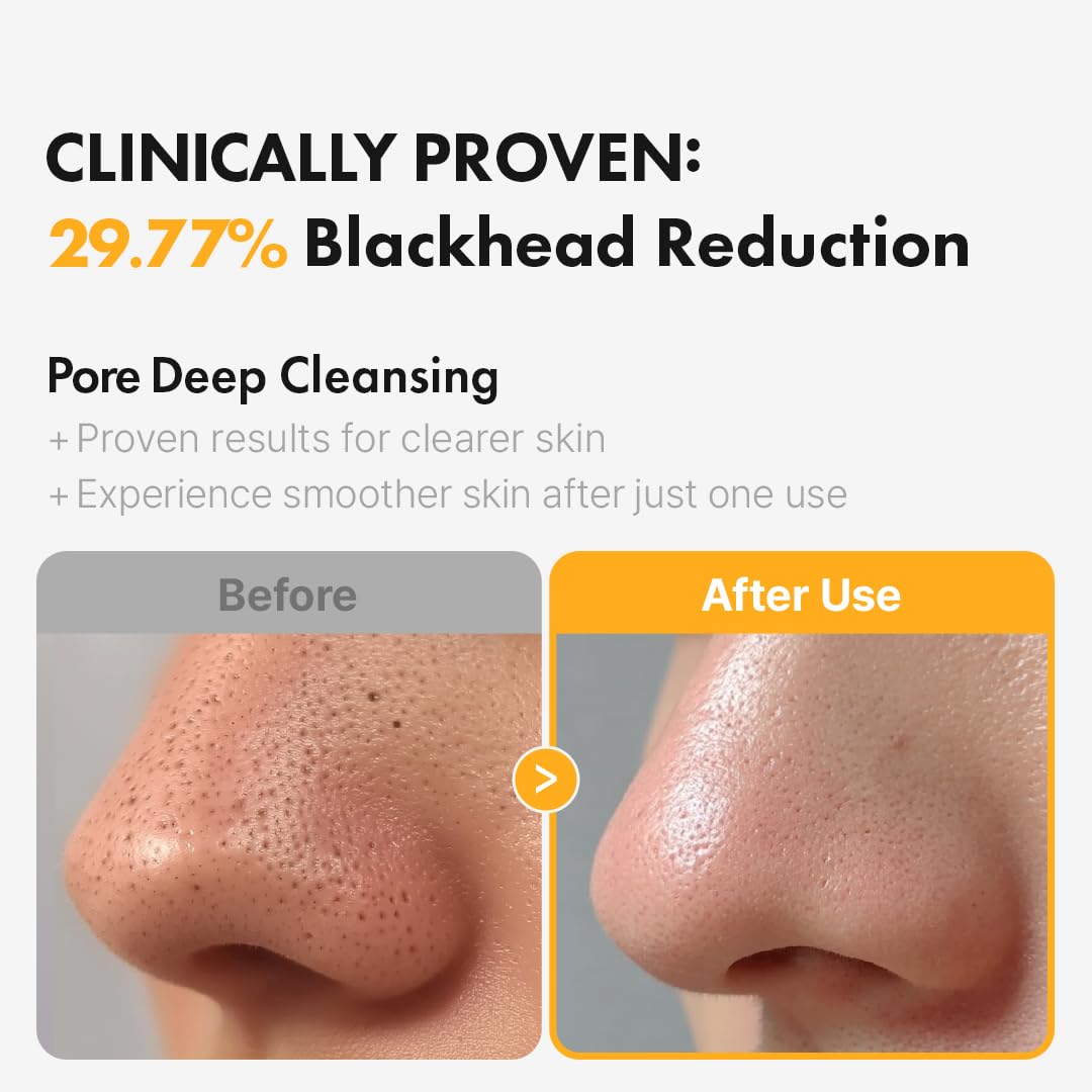 Hanskin PHA Pore Cleansing Oil for Sensitive Skin, Makeup Remover, 10.14 oz
