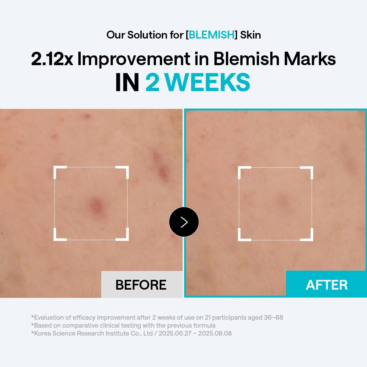 MEDIHEAL Madecassoside Blemish Care Toner Pad