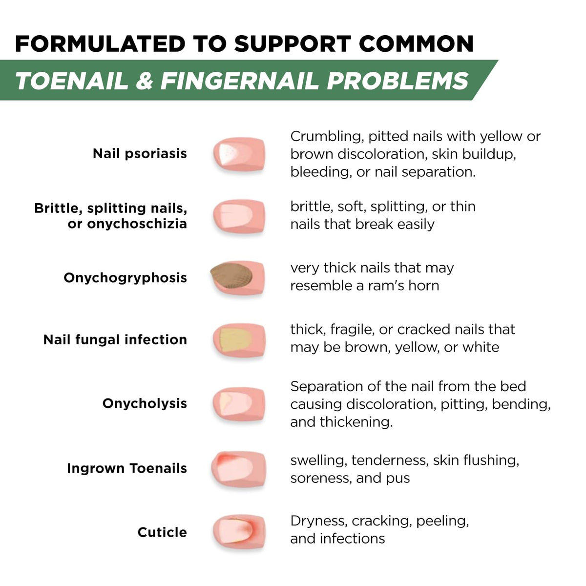 Toenail Fungus Treatment Extra Strength for Ingrown and Discolored Nails
