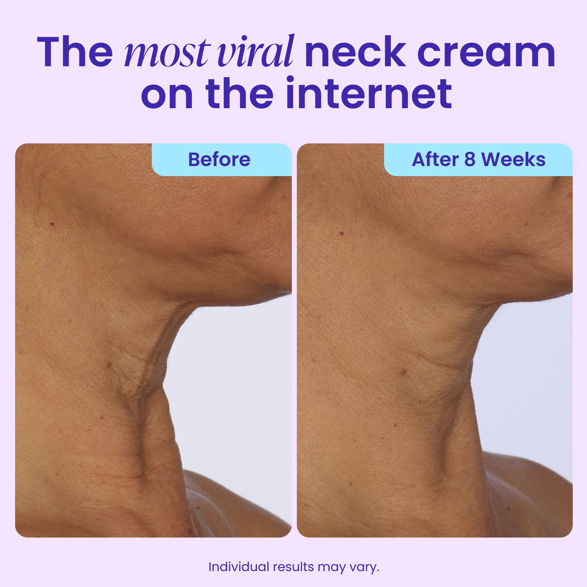goPure Tighten & Lift Neck & Chest Moisturizer Cream for Visibly Firming, Tightening and Lifting the Look of Wrinkles & Crepey Skin, 1.7oz
