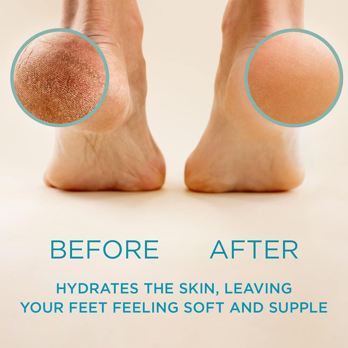 Lee Beauty 8oz Professional Gel Callus Remover for Feet - Original Fast-Acting Formula, Extra Strength for Cracked Heels & Dead Skin (Pack of 1)