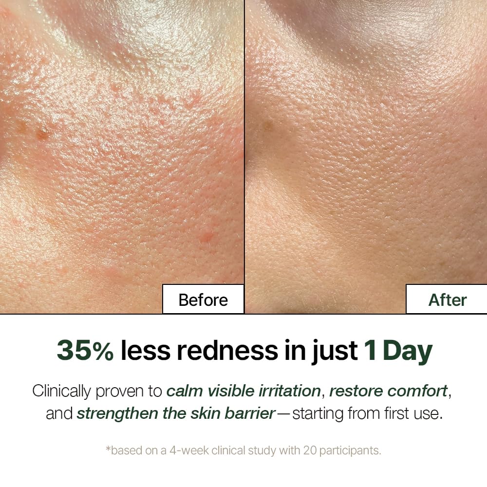 NATURAL DERMA PROJECT NDP Cica Cream - Gel Face Moisturizer for Sunburn Relief, lightweight Korean Moisturizer for Sensitive Skin, Centella Asiatica, Hydrating, Calming, Soothing (1.7 Fl oz / 50ml)