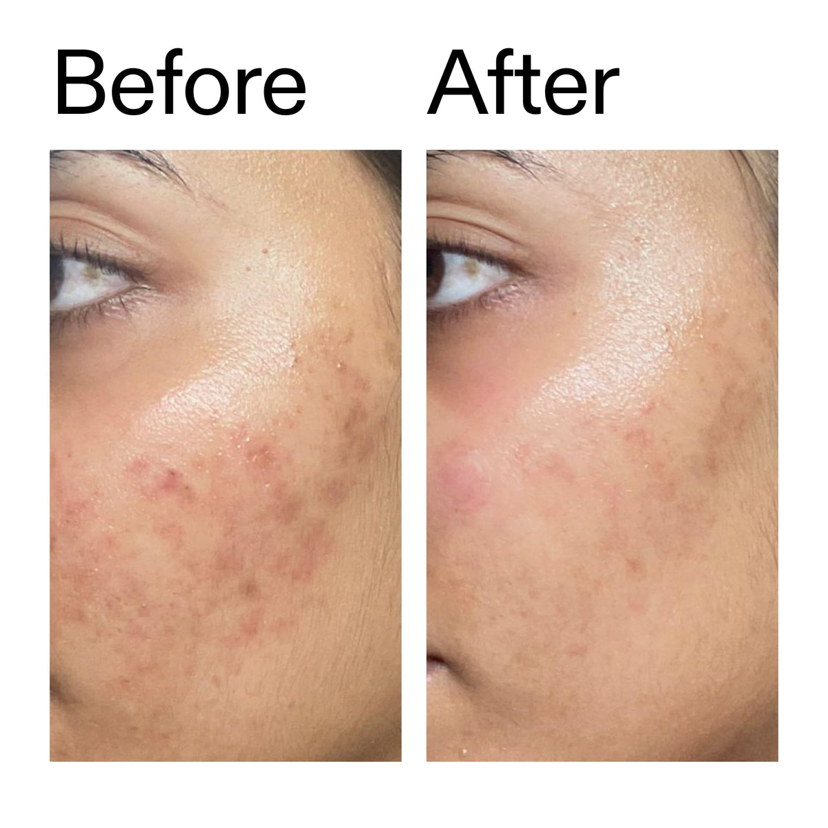 The INKEY List Ectoin Hydro-Barrier Serum, Advanced Dual-Action Serum, Boosts Hydration, Builds Stronger Skin Barrier, Lightweight Texture