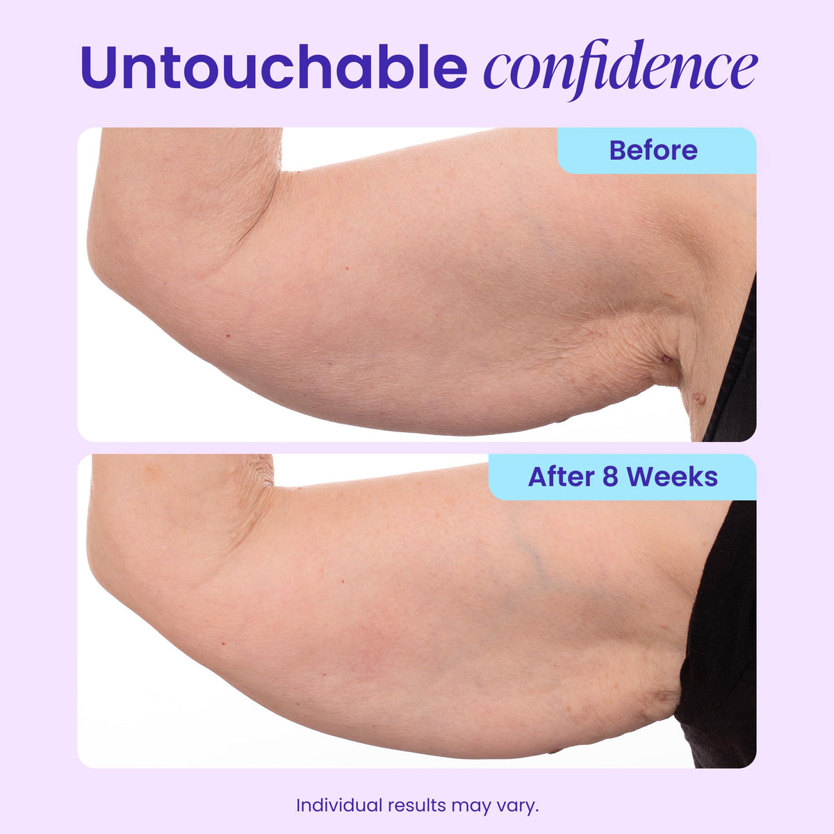 goPure Sculpt & Tone Arm Cream - Firming & Tightening Cream - Smooths, Lifts, Sculpts the Look Of Arms - ProTight Complex - Rice Protein, Shea Butter, Avocado - Clinically Tested - All Skin Types