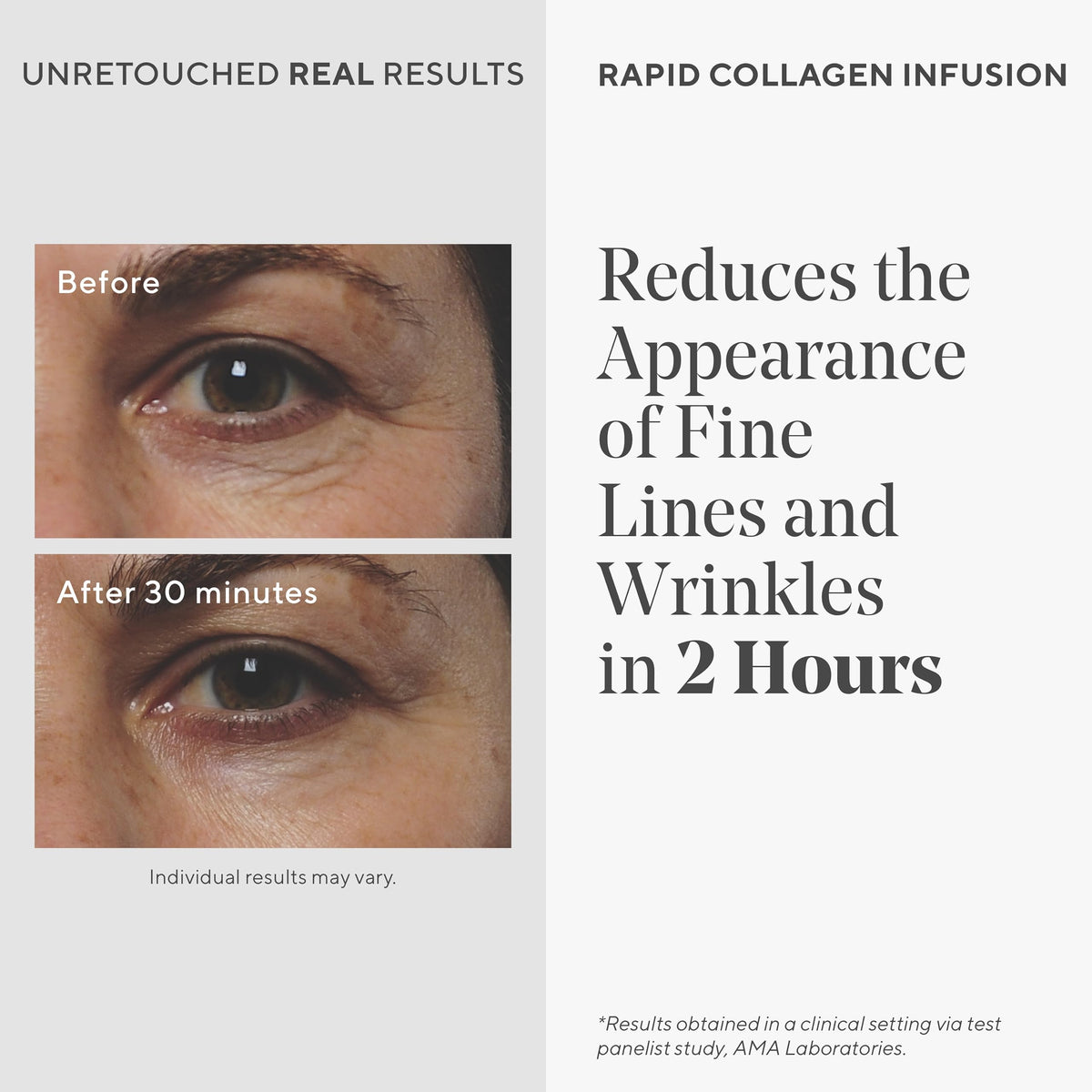 Murad Rapid Collagen Infusion - Collagen Amino Acids - 1 Fl Oz