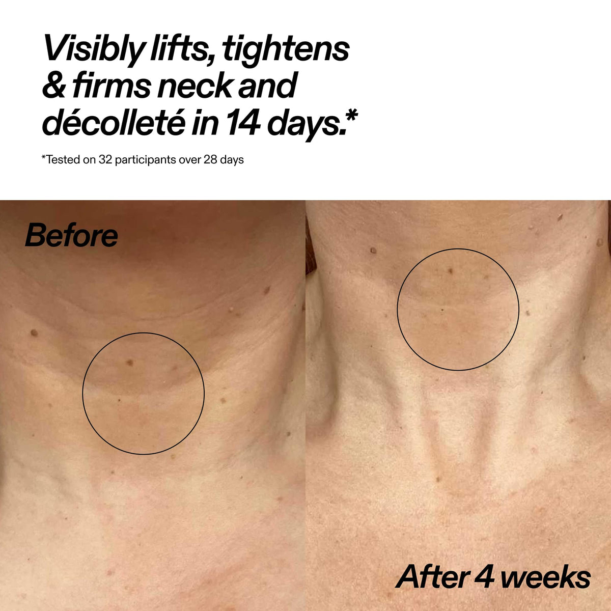 The INKEY List Bioactive Ceramide Neck Stick 20g