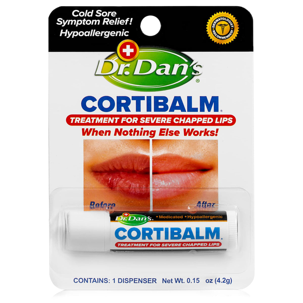 Dr. Dan's Cortibalm 1-Pack Lip Balm with 1% Hydrocortisone for Cracked Lips
