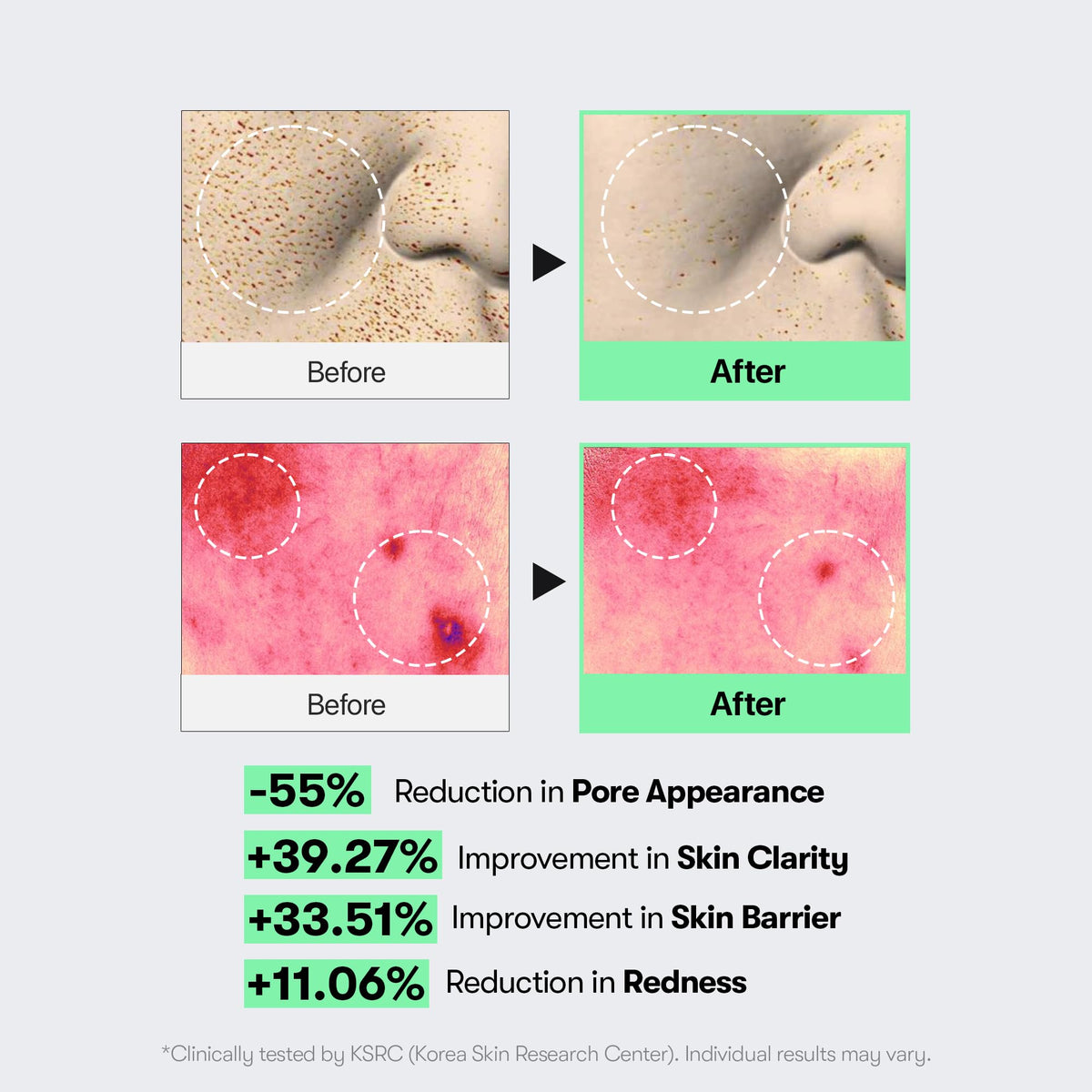 VT COSMETICS CICA Reedle Shot 100 Microneedling Serum