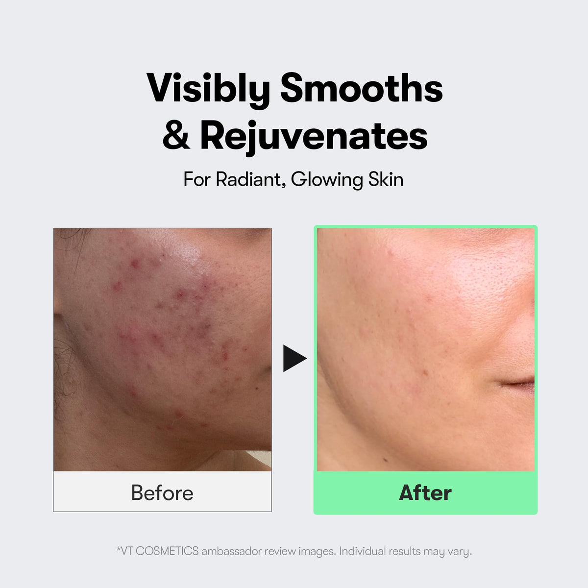 VT COSMETICS CICA Reedle Shot 100 Microneedling Serum