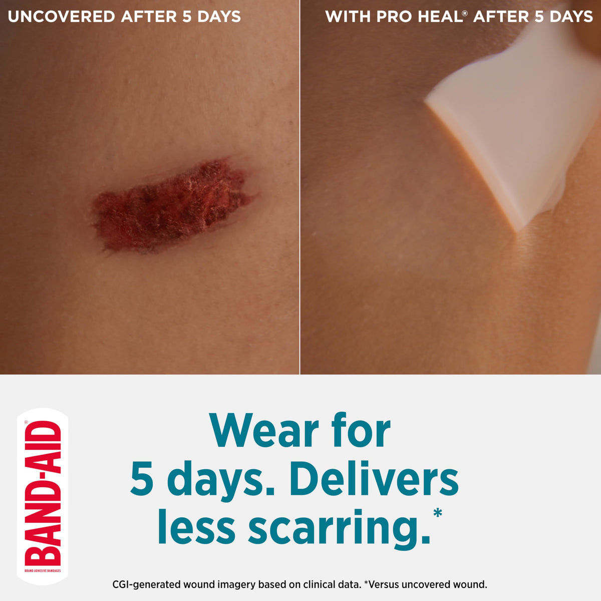 BAND-AID Brand Pro Heal 5 Day Protect Hydrocolloid Bandages, Assorted, 14ct