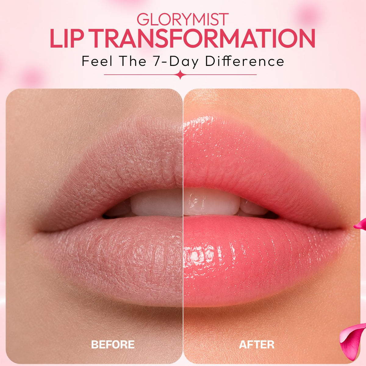 Complete Lip Care Kit for Dry, Dark & Chapped Lips | Daily 3-Step Care