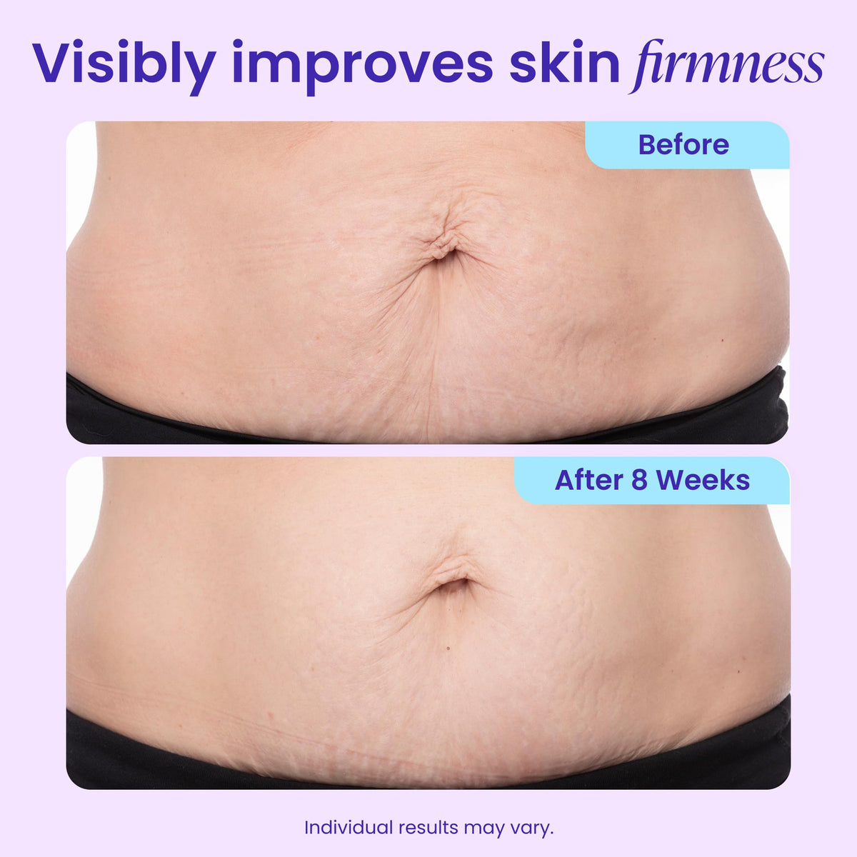 GOPURE Tighten & Smooth Belly Cream - Clinically Tested with MicroTight4 Complex to Reduce the Appearance of Cellulite & Stretch Marks - Quick Absorbing for Smoother, Firmer-Looking Skin, 4.25oz