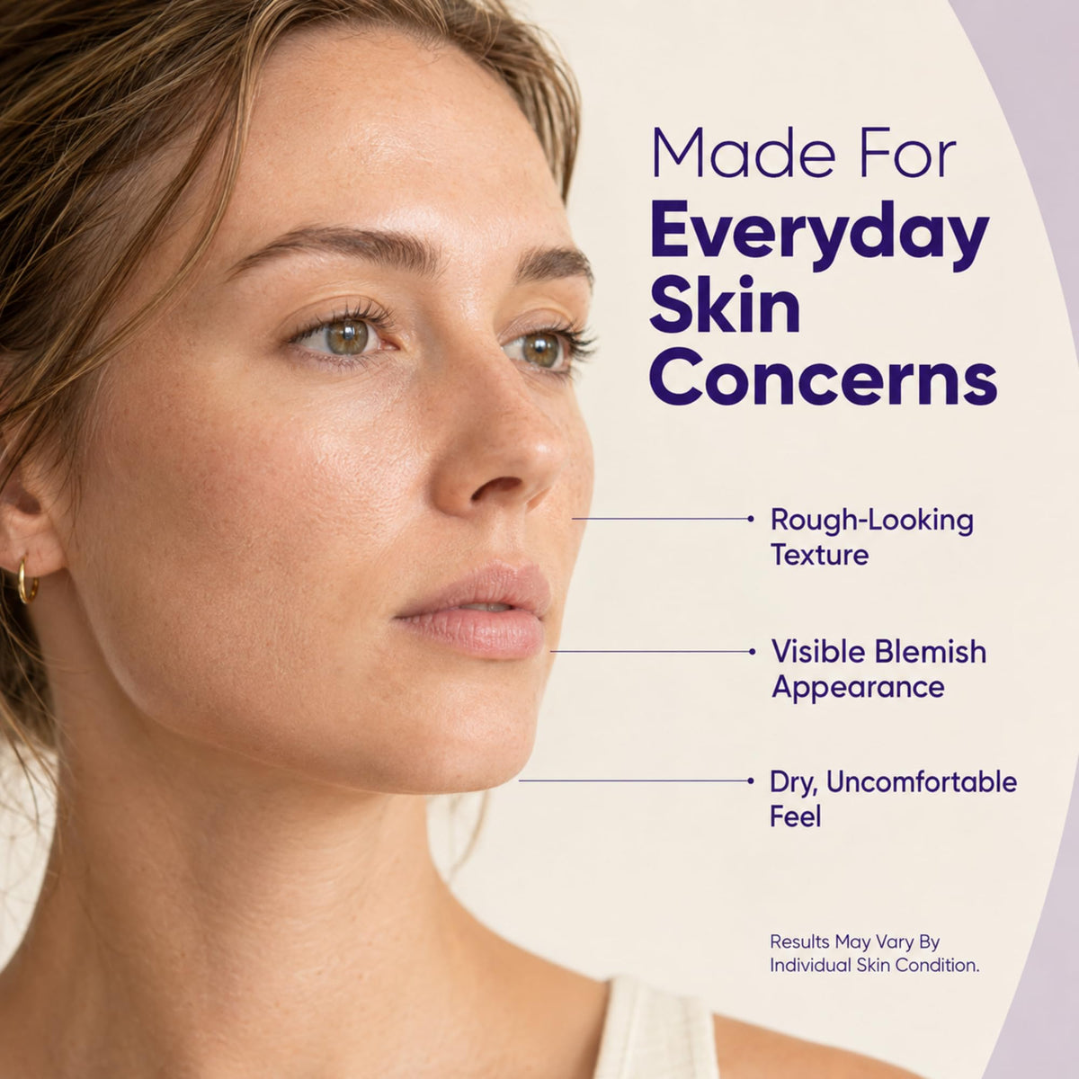 Daily Moisturizing Face Cream With 14% Azelaic Acid & Niacinamide（1 pc）