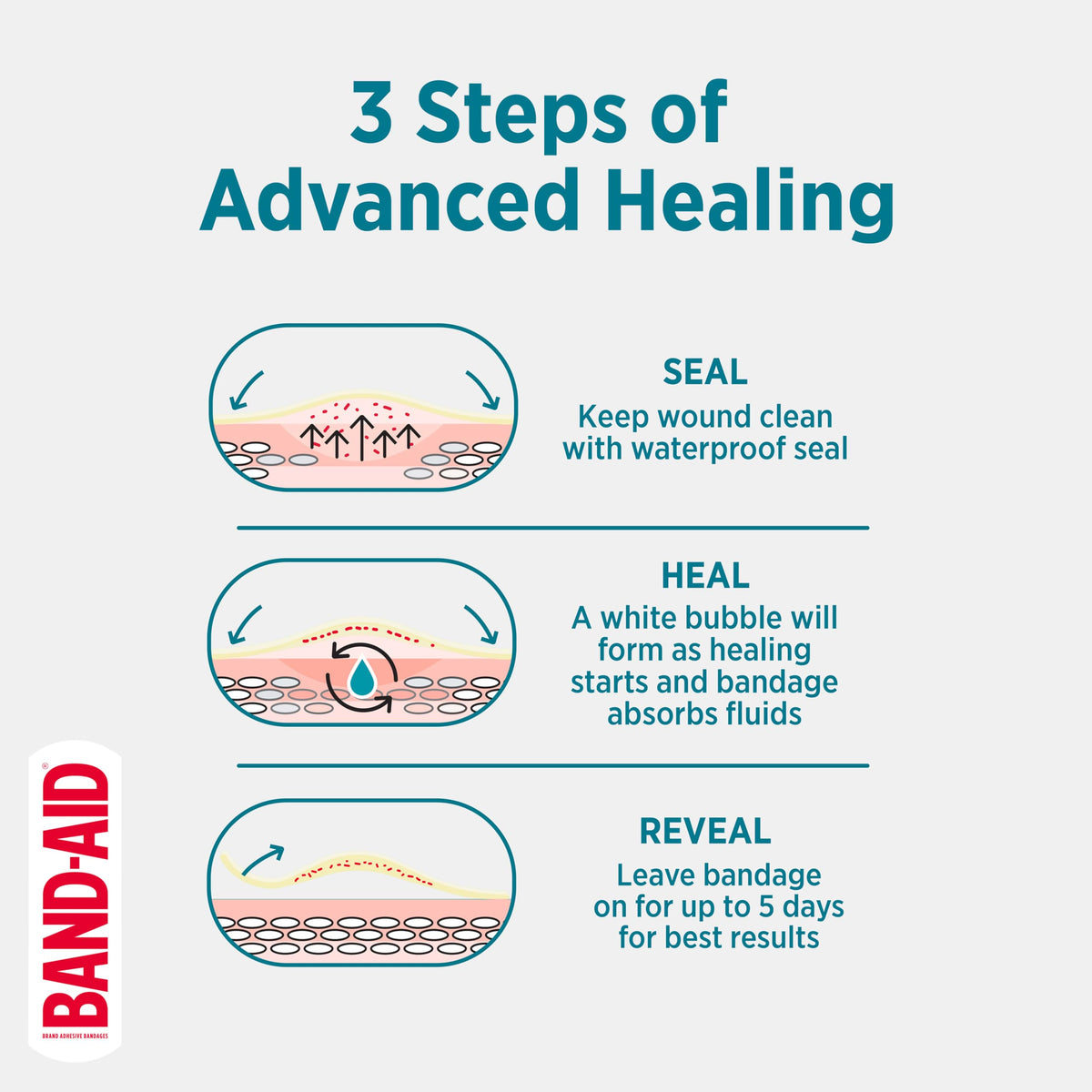 BAND-AID Brand Pro Heal 5 Day Protect Hydrocolloid Bandages, Assorted, 14ct