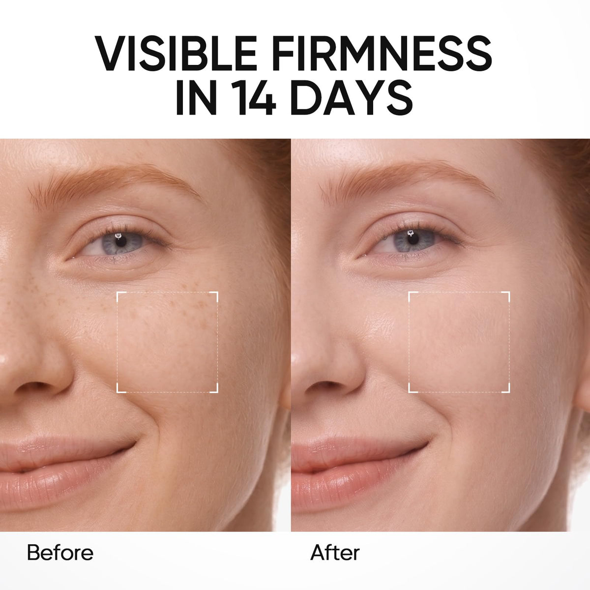 SKINTIFIC PDRN Brightening Serum with 5000 PPM PDRN & 10% Niacinamide