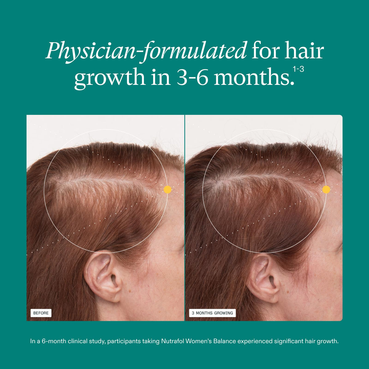 Nutrafol Women's Balance Hair Growth Supplements, Age 45+, 1-Month Bottle