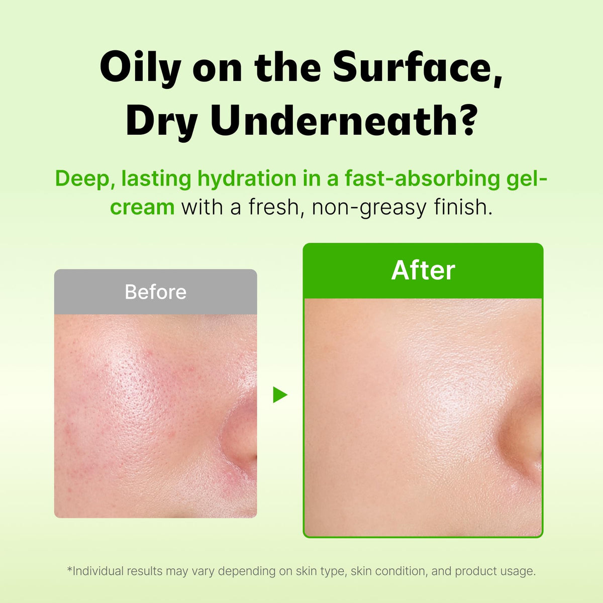 ISOI Moisture Dr. Soothing Cream, Face & Neck Moisturizer, 2.37 fl oz