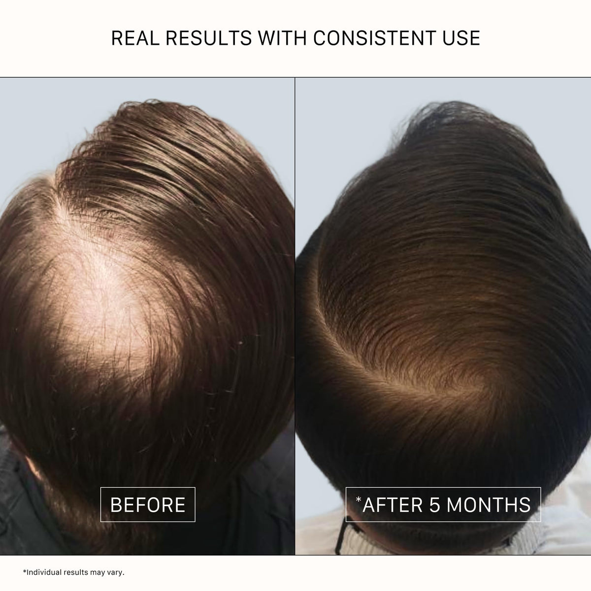 ACTIIV Recover Thickening Shampoo Treatment For Men | Fuller Hair, 7 Fl Oz