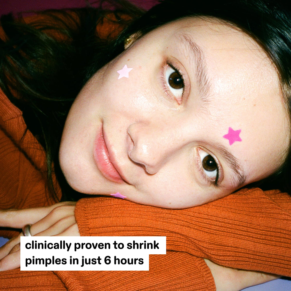 Starface HydroStar Pink Hydrocolloid Star-Shaped Pimple Patch Refill, 36 ct