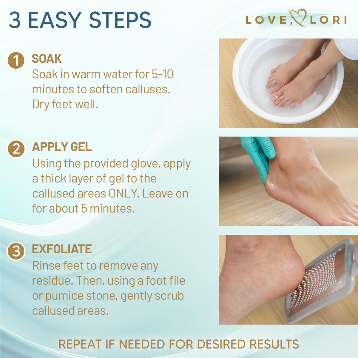 Love Lori Foot Callus Remover Kit - Gel & Foot Scraper for Dead Skin, 6oz