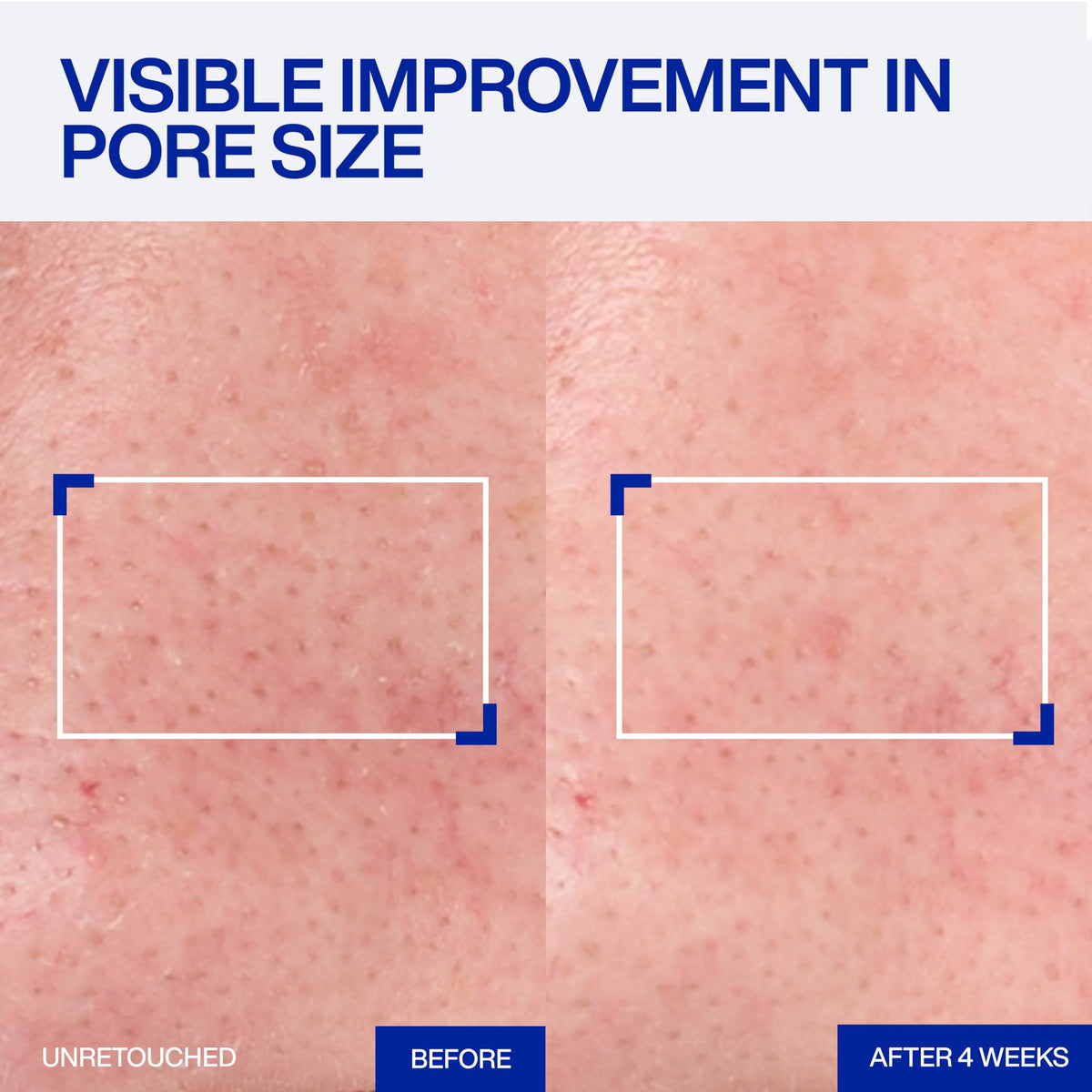 IOPE Expert Retinol RX 1% Super Bounce Serum - Gentle Anti-Aging Face Serum for Beginners - Visibly Firms Skin, Refines Pores, and Smooths Wrinkles - 1.01 fl. oz.