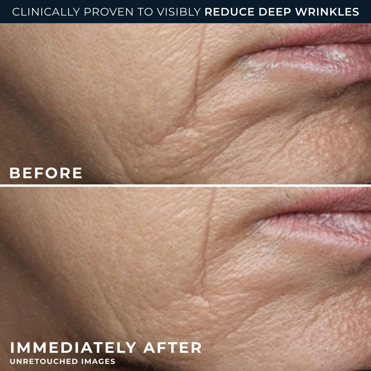 RoC Deep Wrinkle Rich Cream, Daily Anti-Aging Firming Cream, fragrance-free