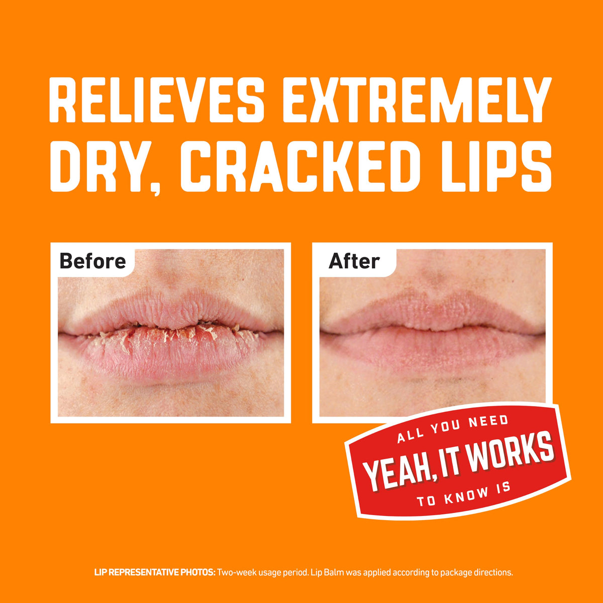 OKeeffes Lip Repair SPF 35 Balm, Moisturizer for Cracked Lips, 3-Pack