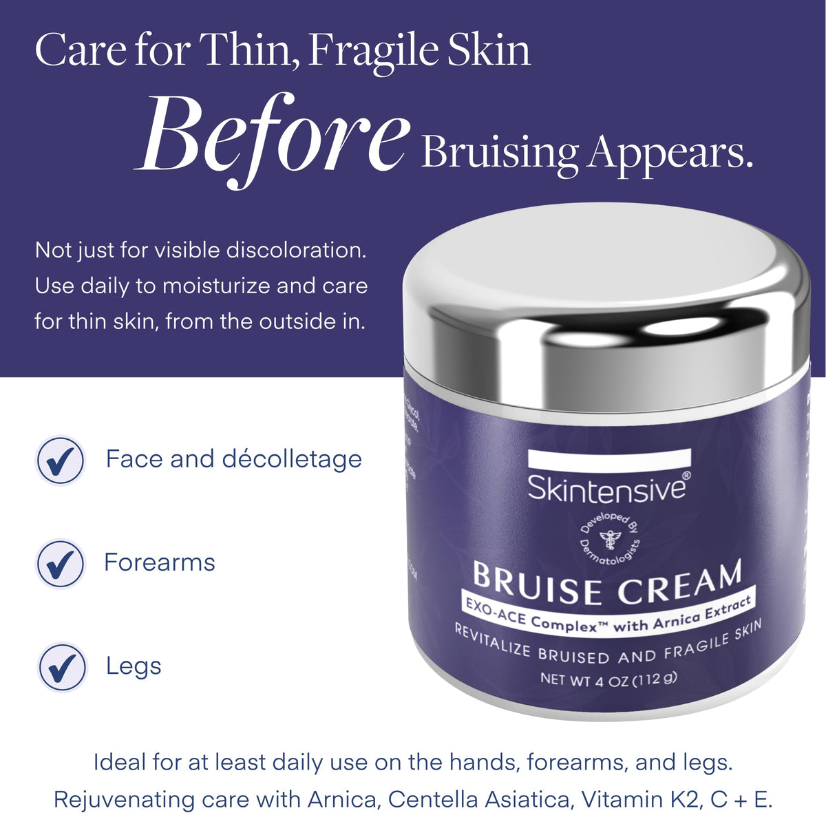 SKINTENSIVE Arnica Bruise Cream for Thin Skin – Vitamin K Cream for Bruises & Skin Discoloration, Moisturizing Arnica Cream, Non-Greasy Formula, 4 Oz