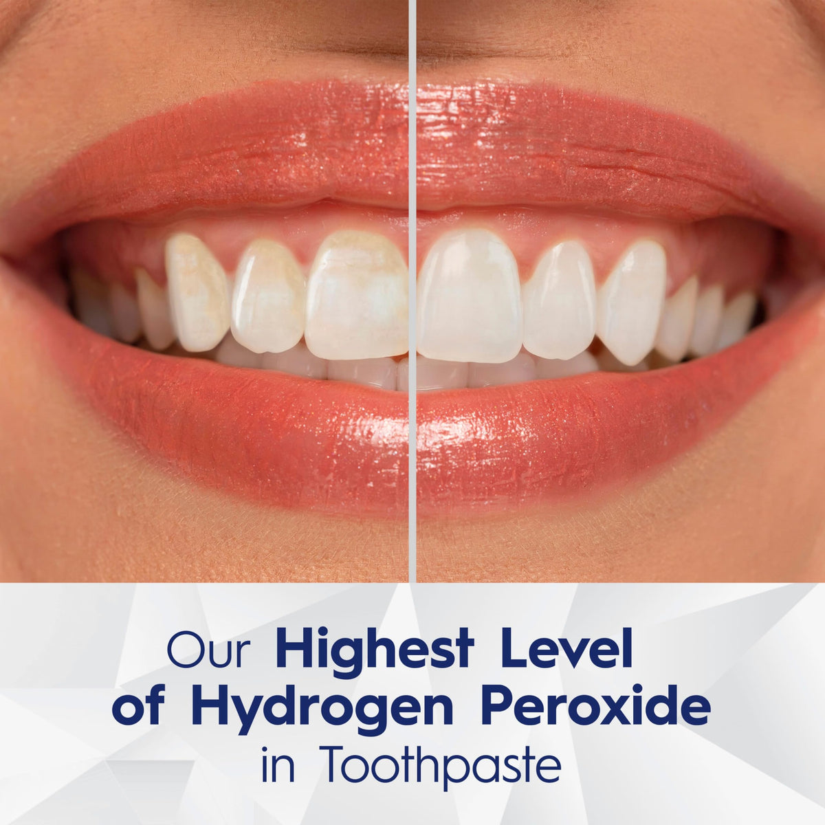 Crest 3D White Brilliance PRO Ultra White Teeth Whitening Toothpaste, 4% Hydrogen Peroxide, 3.8 oz (Pack of 1), Enamel Safe Fluoride Anticavity Toothpaste