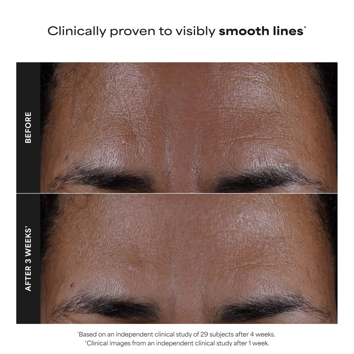 Paula's Choice SKIN PERFECTING 2% BHA Liquid Leave-On Exfoliant, 4 Fl Oz