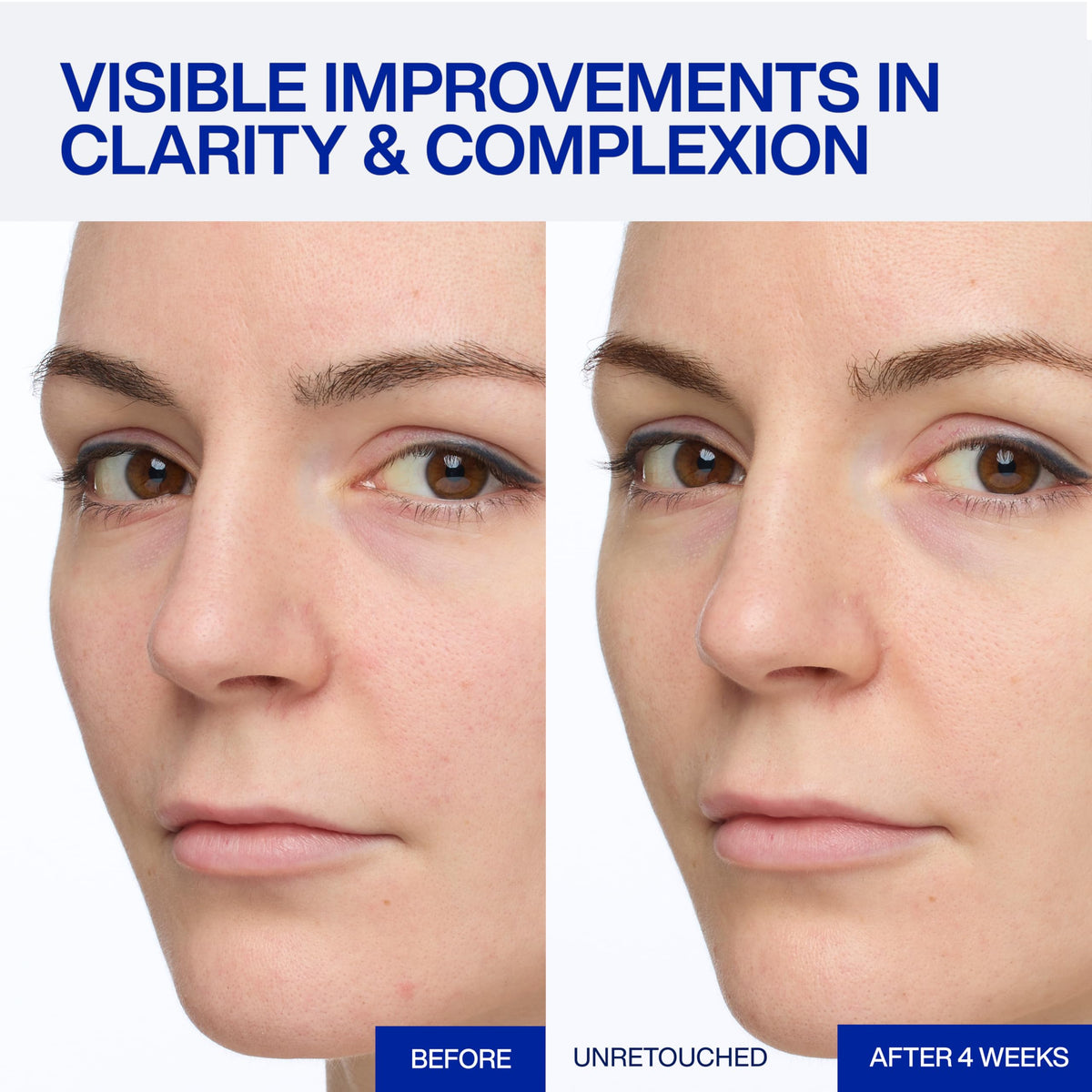 IOPE Expert Vitamin C 25% Antioxidant Serum - 25% Pure Vitamin C Face Serum - Visibly Evens Skin Tone, Enhances Radiance, and Smooths Texture – 5 Antioxidants and PHA - 0.77 fl. oz.