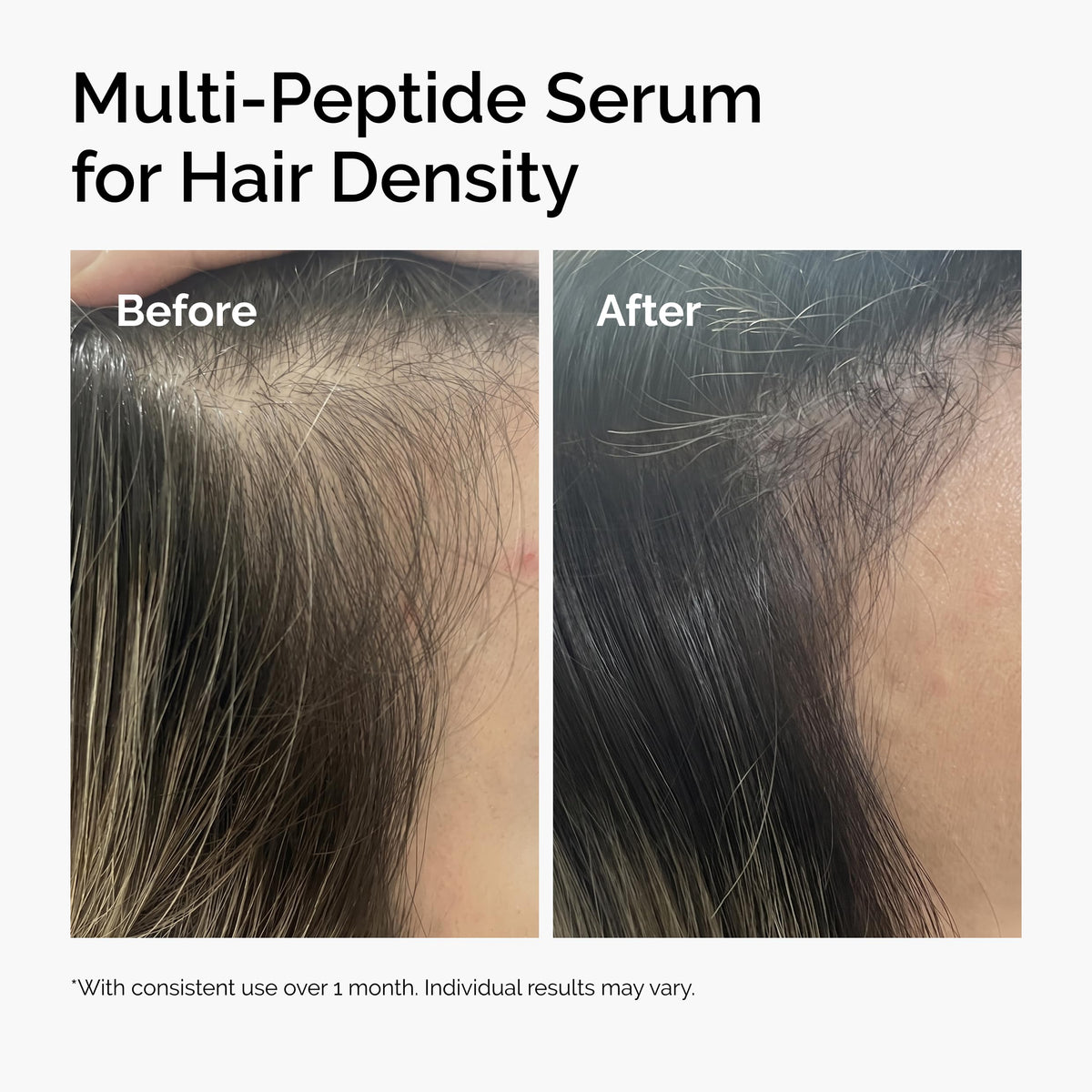 The Ordinary Multi-Peptide Serum for Hair Density, Peptide-Powered Formula for Thicker, Fuller Looking Hair, 2 Fl Oz