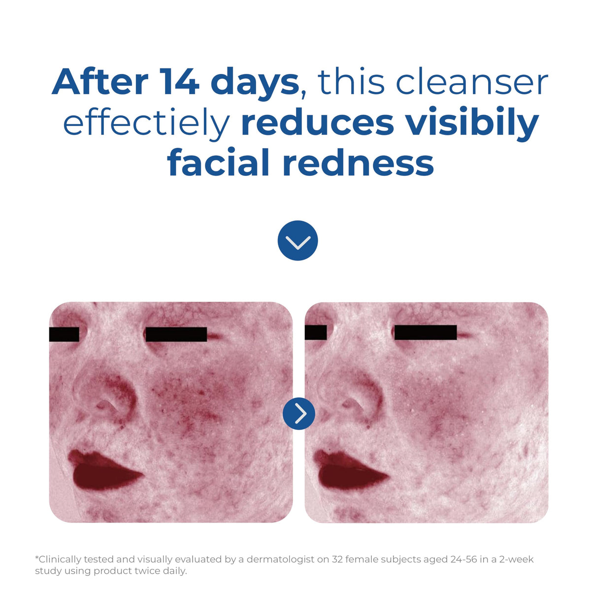 EltaMD Skin Recovery Amino Acid Foaming Face Wash, Fragrance-Free, 5 oz