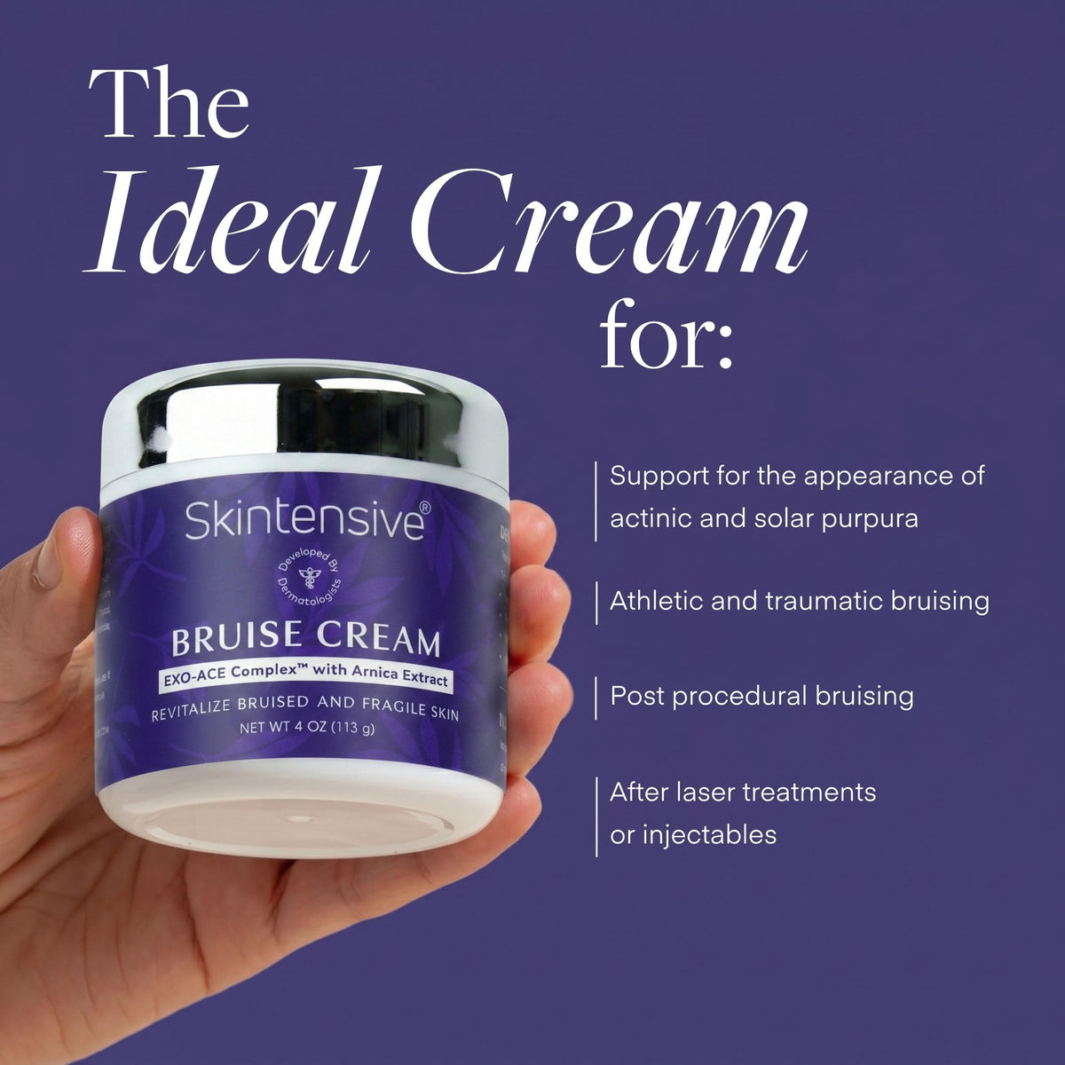 SKINTENSIVE Arnica Bruise Cream for Thin Skin – Vitamin K Cream for Bruises & Skin Discoloration, Moisturizing Arnica Cream, Non-Greasy Formula, 4 Oz