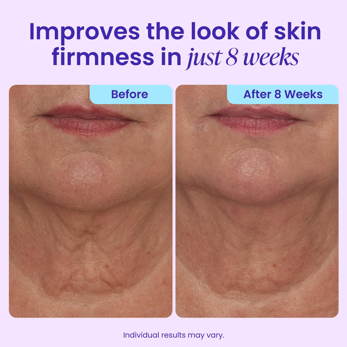 goPure Tighten & Lift Neck & Chest Moisturizer Cream for Visibly Firming, Tightening and Lifting the Look of Wrinkles & Crepey Skin, 1.7oz