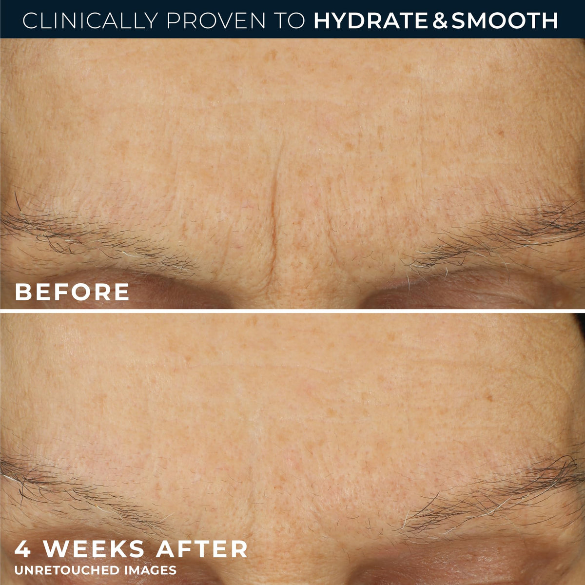 RoC Retinol Correxion Max Daily Hydration Face Moisturizer, Hyaluronic Acid
