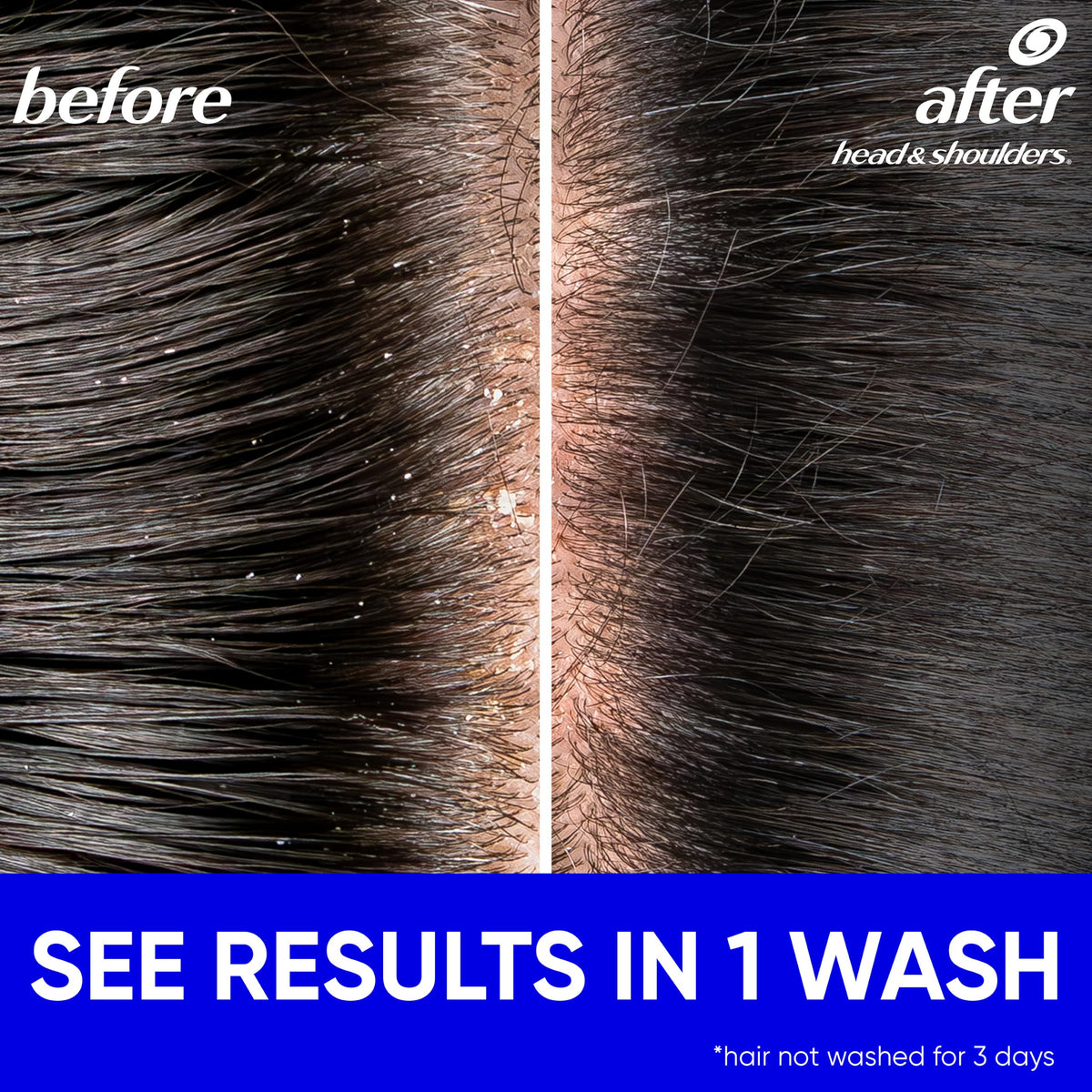 Head & Shoulders Classic Clean Anti-Dandruff Shampoo, 72-Hour Dandruff Protection, 1% Pyrithione Zinc, 28.2 fl oz