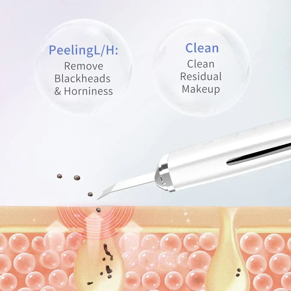 Electric Facial Skin Scrubber Spatula