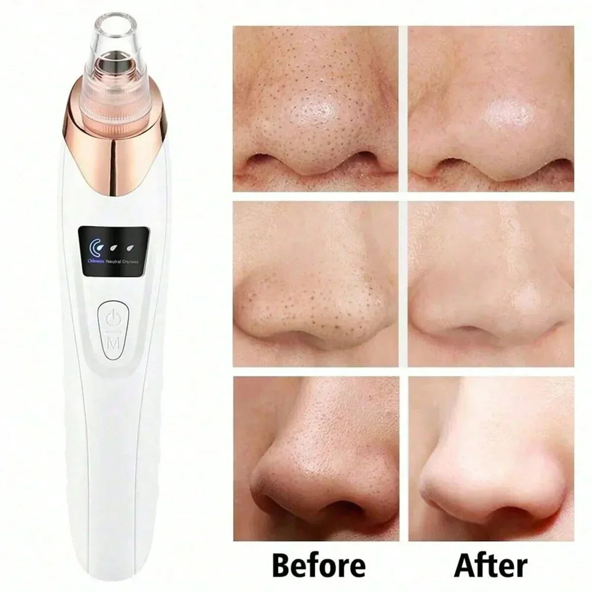 Electric Blackhead Pore Vacuum