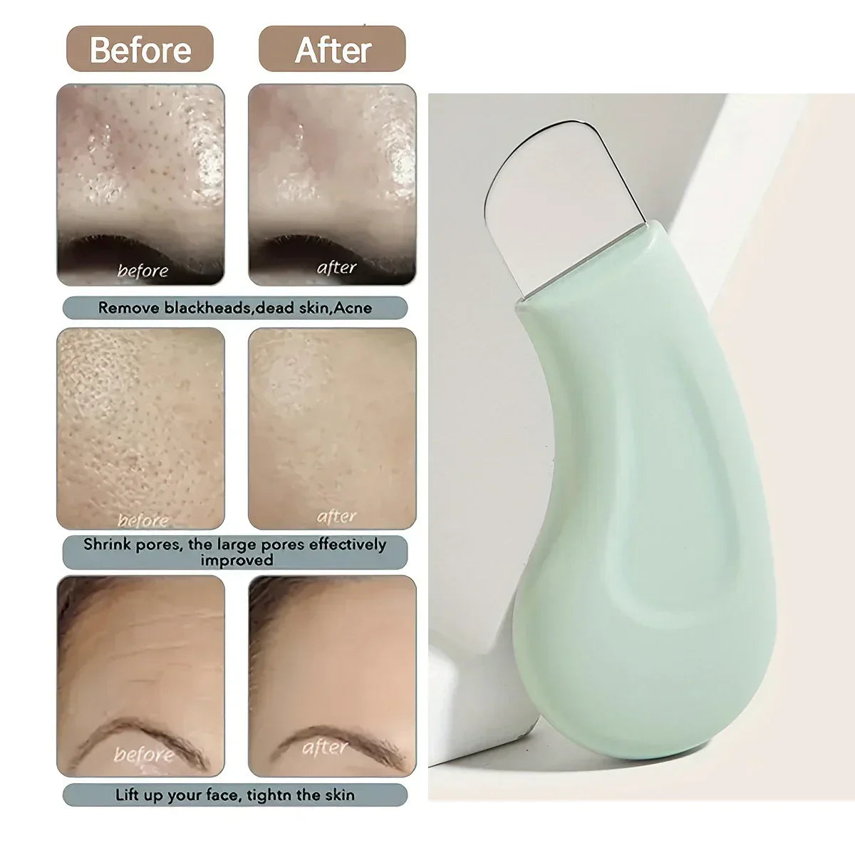 Facial Blackhead Removal Skin Tool