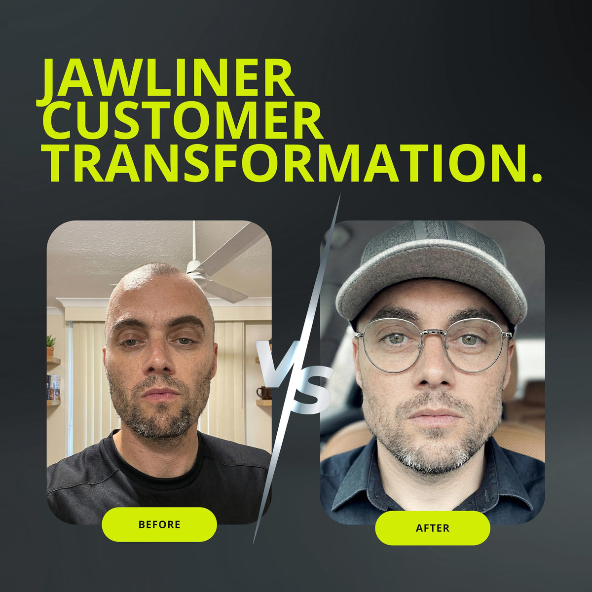 Jawliner Ultra15x Harder Jawline Gum with 12 Weeks Coaching – Sugar-Free Mastic Gum for Jaw Shaping