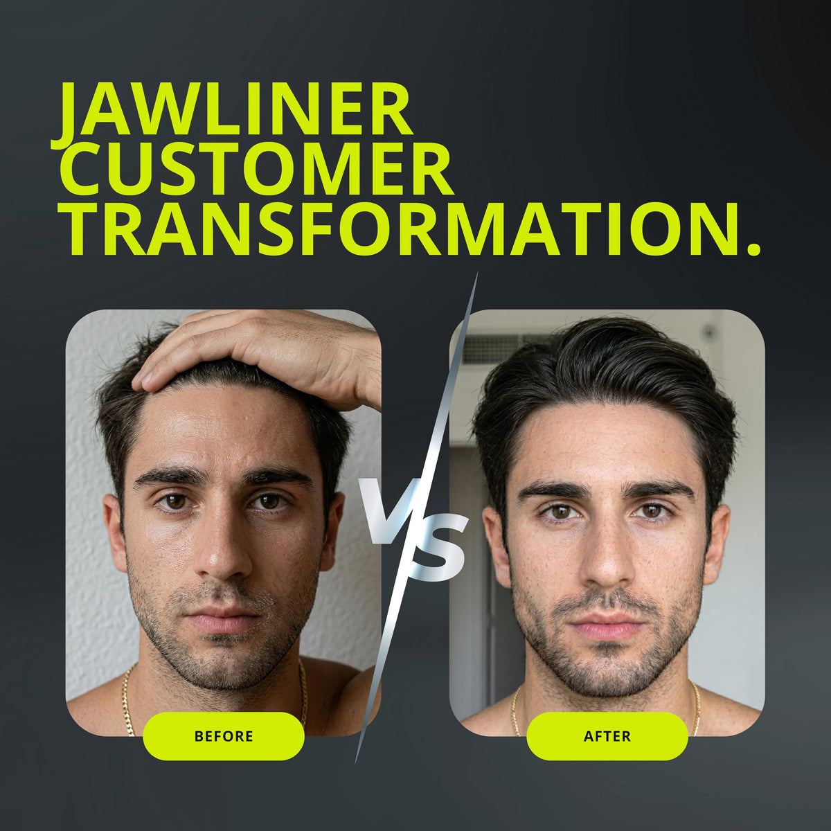 Jawliner Ultra15x Harder Jawline Gum with 12 Weeks Coaching – Sugar-Free Mastic Gum for Jaw Shaping